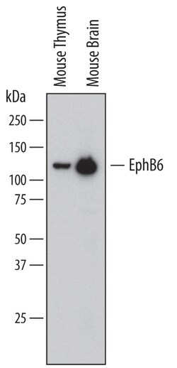 Mouse EphB6 Biotinylated Antibody, R D Systems 50&mu;g; Biotin:Antibodies,