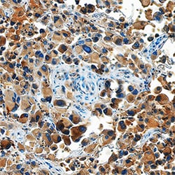 Human Ephrin-A5 Antibody, R D Systems 25&mu;g; Unlabeled:Antibodies, Polyclonal
