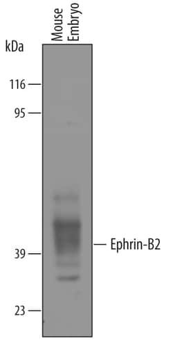 Human/Mouse/Rat Ephrin-B2 Antibody, R D Systems 25&mu;g; Unlabeled:Antibodies,