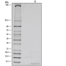 R D Systems Recombinant Human Epiregulin Protein Lyophilized from a 0.2&mu;m filtered solution in PBS. | Buy Online | R&amp;D Systems&trade; | Fisher Scientific