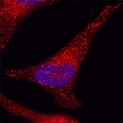 Human Eps15 Antibody, R D Systems 25&mu;g; Unlabeled:Antibodies, Polyclonal