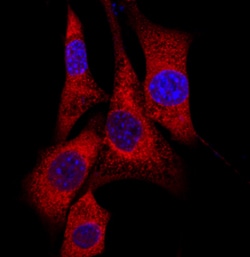 Human Eps15 Antibody, R D Systems 25&mu;g; Unlabeled:Antibodies, Polyclonal