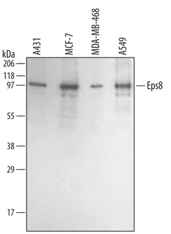 Human Eps8 Antibody, R D Systems 25 &mu;g | Buy Online | R&D Systems | Fisher Scientific
