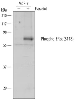 Human Phospho-ER alpha/NR3A1 (S118) Antibody, R D Systems 100&mu;g; Unlabeled:Antibodies,