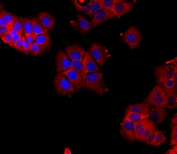 ER beta/NR3A2 Mouse anti-Human, Clone: 733930, R D Systems 25&mu;g; Unlabeled,