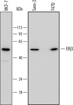 ER beta/NR3A2 Mouse anti-Human, Clone: 733930, R D Systems 25&mu;g; Unlabeled,