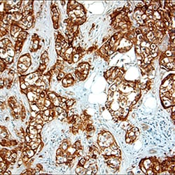 Human ErbB2/Her2 Antibody, R D Systems 100&mu;g; Unlabeled:Antibodies,