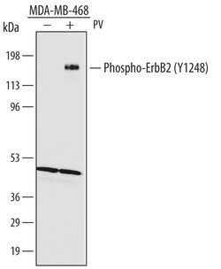Human Phospho-ErbB2/Her2 (Y1248) Antibody, R D Systems 50&mu;g; Unlabeled:Antibodies,