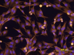 Human ErbB2/Her2 Antibody, R D Systems 100&mu;g; Unlabeled:Antibodies,