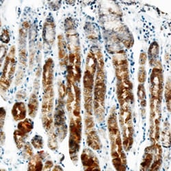 Human ErbB2/Her2 Antibody, R D Systems 100&mu;g; Unlabeled:Antibodies,