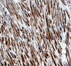Human ErbB4/Her4 Antibody, R D Systems 500ug; Unlabeled:Antibodies, Monoclonal