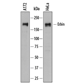 Human Erbin Antibody, R D Systems 25&mu;g; Unlabeled:Antibodies, Polyclonal