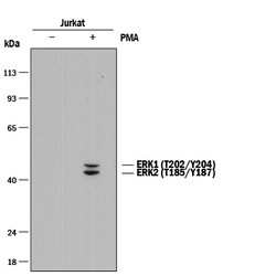 Human/Mouse Phospho-ERK1 (ERK1 T202/Y204, ERK2 T185/Y187) Antibody, R D