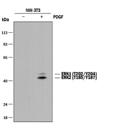 Human/Mouse Phospho-ERK1 (ERK1 T202/Y204, ERK2 T185/Y187) Antibody, R D