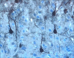Human/Mouse/Rat Phospho-ERK1(T202/Y204)/ERK2 (T185/Y187) Antibody, R D
