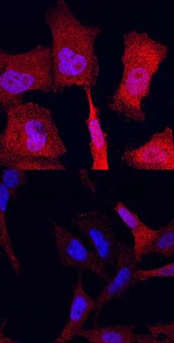 Human/Mouse/Rat Phospho-ERK1 (T202/Y204)/ERK2 (T185/Y187) Antibody, R D