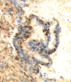 Human ERK3 Antibody, R D Systems 25&mu;g; Unlabeled:Antibodies, Monoclonal