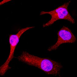 Human/Mouse ERK5/BMK1 Antibody, R D Systems 100&mu;g; Unlabeled:Antibodies,