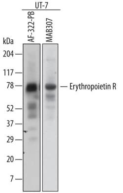 Human Erythropoietin R Antibody, R D Systems 100&mu;g; Unlabeled:Antibodies,