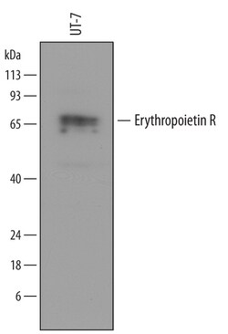 Human Erythropoietin R Antibody, R D Systems 100ug; Unlabeled:Antibodies,