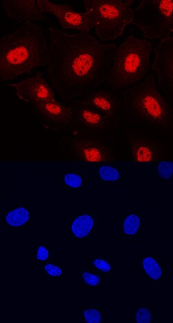 Human ETV5 Antibody, R D Systems 25&mu;g; Unlabeled:Antibodies, Monoclonal