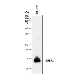 Human/Mouse/Rat FABP1/L-FABP Antibody, R D Systems 100&mu;g; Unlabeled:Antibodies,
