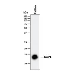 Mouse/Rat FABP1/L-FABP Antibody, R D Systems 25&mu;g; Unlabeled:Antikörper