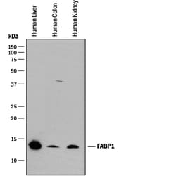 Human/Mouse/Rat FABP1/L-FABP Antibody, R D Systems 100ug; Unlabeled:Antibodies,