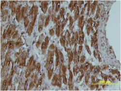 Human FABP3/H-FABP Biotinylated Antibody, R D Systems 50&mu;g; Biotin:Antibodies,
