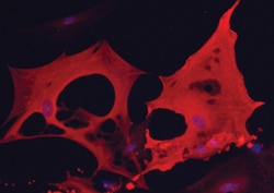 Mouse/Rat FABP4/A-FABP Antibody, R D Systems 25&mu;g; Unlabeled:Antibodies,