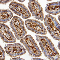 Mouse/Rat FABP4/A-FABP Antibody, R D Systems 25&mu;g; Unlabeled:Antibodies,