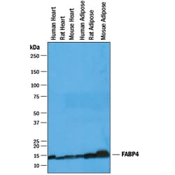 Human FABP4/A-FABP Antibody, R D Systems 100 &mu;g | Buy Online | R&D Systems | Fisher Scientific