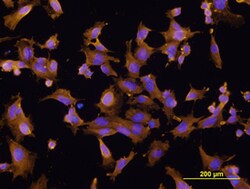 Human FABP5/E-FABP Antibody, R D Systems 25&mu;g; Unlabeled:Antibodies,