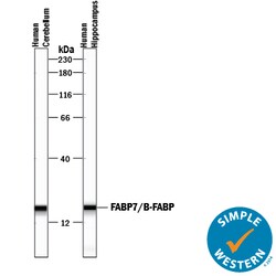 Human FABP7/B-FABP Antibody, R D Systems 100&mu;g; Unlabeled:Antibodies,