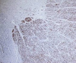 Human FABP8/M-FABP Antibody, R D Systems 25&mu;g; Unlabeled:Antibodies,