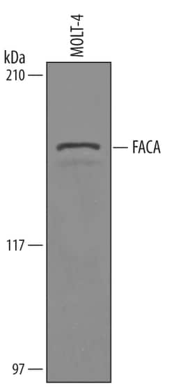 Human FACA/FANCA Antibody, R D Systems 100&mu;g; Unlabeled:Antibodies,
