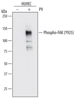 Human Phospho-FAK (Y925) Antibody, R D Systems 100ug; Unlabeled:Antibodies,