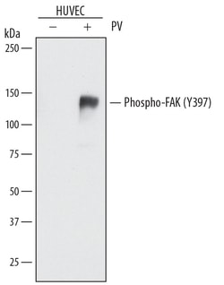 Human Phospho-FAK (Y397) Antibody, R D Systems 25 &mu;g | Buy Online | R&D Systems | Fisher Scientific