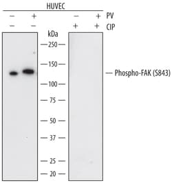 Human Phospho-FAK (S843) Antibody, R D Systems 25 &mu;g | Buy Online | R&D Systems | Fisher Scientific