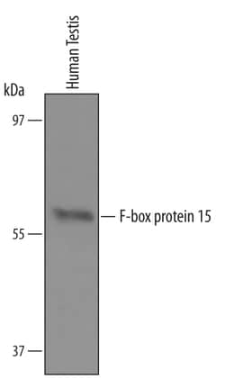 Human F-box protein 15/FBXO15 Antibody, R D Systems 25&mu;g; Unlabeled:Antibodies,