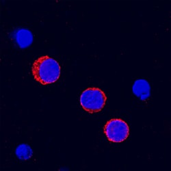 Human Fc gamma RII/CD32 Antibody, R D Systems 100&mu;g; Unlabeled:Antibodies,