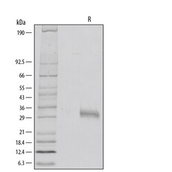 R D Systems Recombinant Human Fc gamma RIIA/CD32a (R167) Protein Lyophilized from a 0.2&mu;m filtered solution in PBS. | Buy Online | R&amp;D Systems&trade; | Fisher Scientific