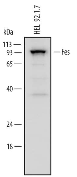 Human Fes Antibody, R D Systems 25&mu;g; Unlabeled:Antibodies, Polyclonal