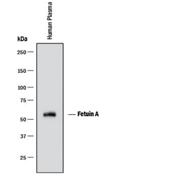 Human Fetuin A/AHSG Antibody, R D Systems 100 &mu;g | Buy Online | R&D Systems | Fisher Scientific