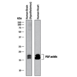 Human FGF acidic/FGF1 Antibody, R D Systems 100&mu;g; Unlabeled:Antibodies,