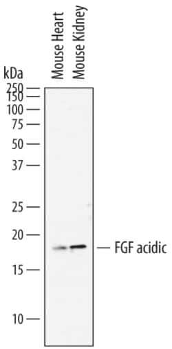Mouse FGF acidic/FGF1 Antibody, R D Systems 25 &mu;g | Buy Online | R&D Systems | Fisher Scientific