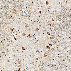 Human FGF acidic/FGF1 Antibody, R D Systems 100&mu;g; Unlabeled:Antibodies,