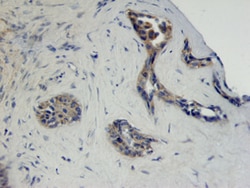 Human FGFR2 Antibody, R D Systems 100&mu;g; Unlabeled:Antibodies, Monoclonal