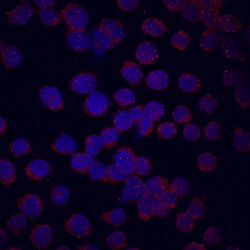 Human FGFR3 (IIIc) Antibody, R D Systems:Antibodies:Primary Antibodies