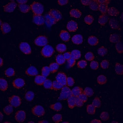 Human FGFR3 (IIIc) Antibody, R D Systems 500&mu;g:Antibodies, Monoclonal